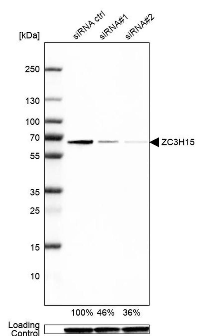 ZC3H15 Antibody in Western Blot (WB)