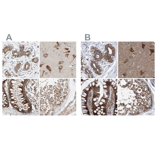 ZC3H15 Antibody in Immunohistochemistry (IHC)