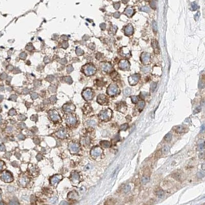 ZC3H15 Antibody in Immunohistochemistry (IHC)