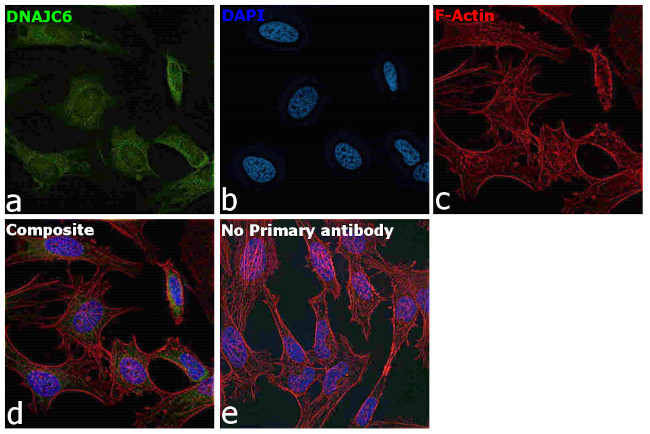 DNAJC6 Antibody in Immunocytochemistry (ICC/IF)