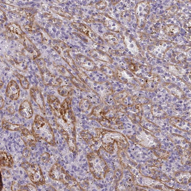 PDE2A Antibody in Immunohistochemistry (IHC)