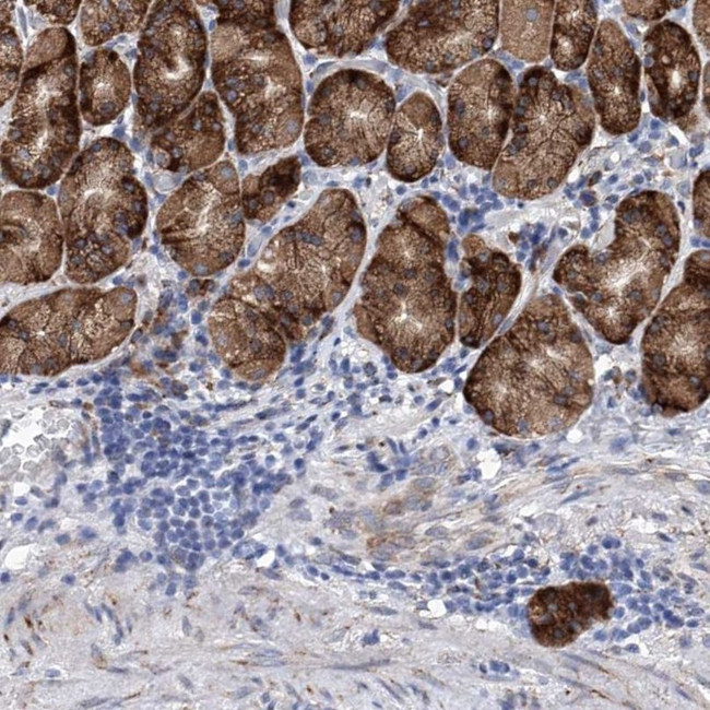 EFCAB2 Antibody in Immunohistochemistry (IHC)