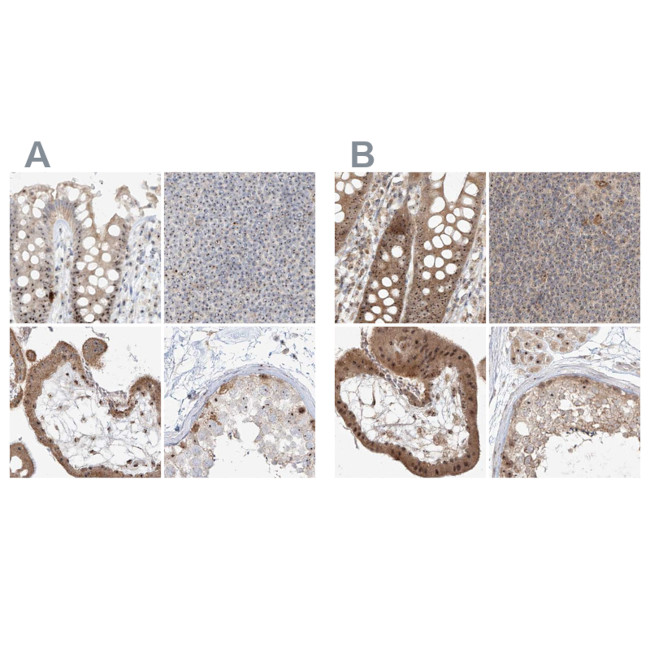 BYSL Antibody in Immunohistochemistry (IHC)