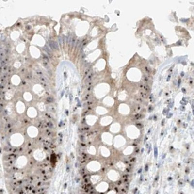 BYSL Antibody in Immunohistochemistry (IHC)