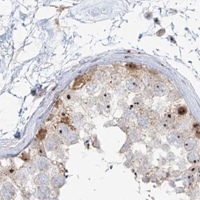 BYSL Antibody in Immunohistochemistry (IHC)