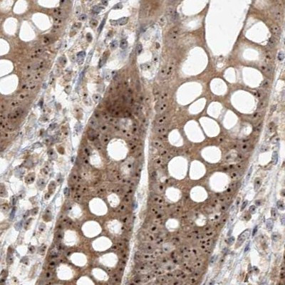 BYSL Antibody in Immunohistochemistry (IHC)