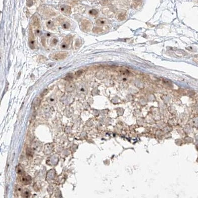 BYSL Antibody in Immunohistochemistry (IHC)