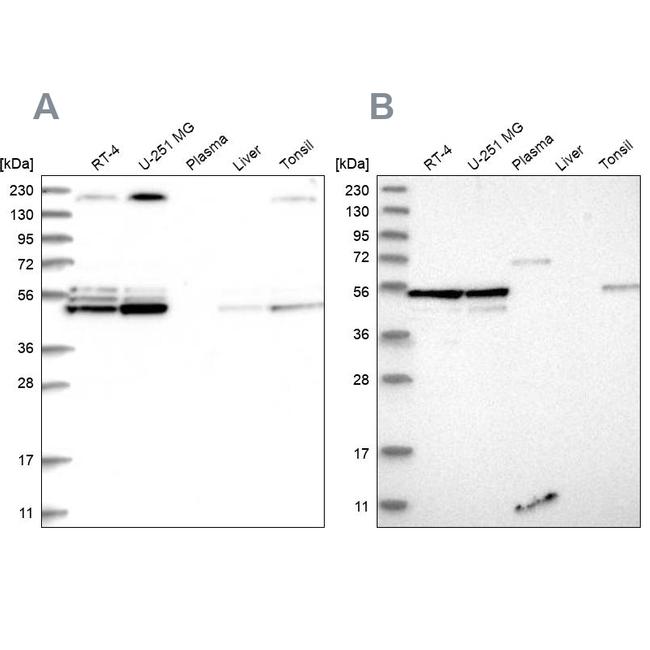 BYSL Antibody in Western Blot (WB)