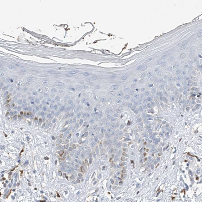 Thromboxane synthase Antibody in Immunohistochemistry (IHC)