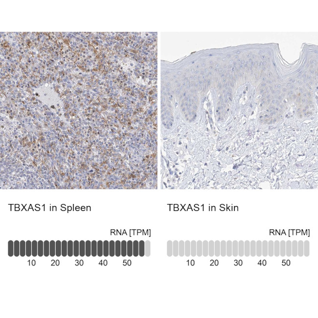 Thromboxane synthase Antibody in Immunohistochemistry (IHC)