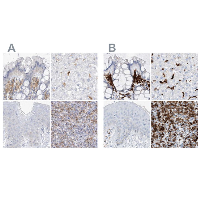 Thromboxane synthase Antibody in Immunohistochemistry (IHC)