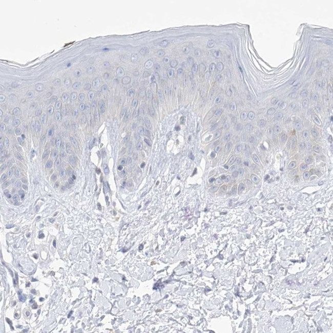 Thromboxane synthase Antibody in Immunohistochemistry (IHC)