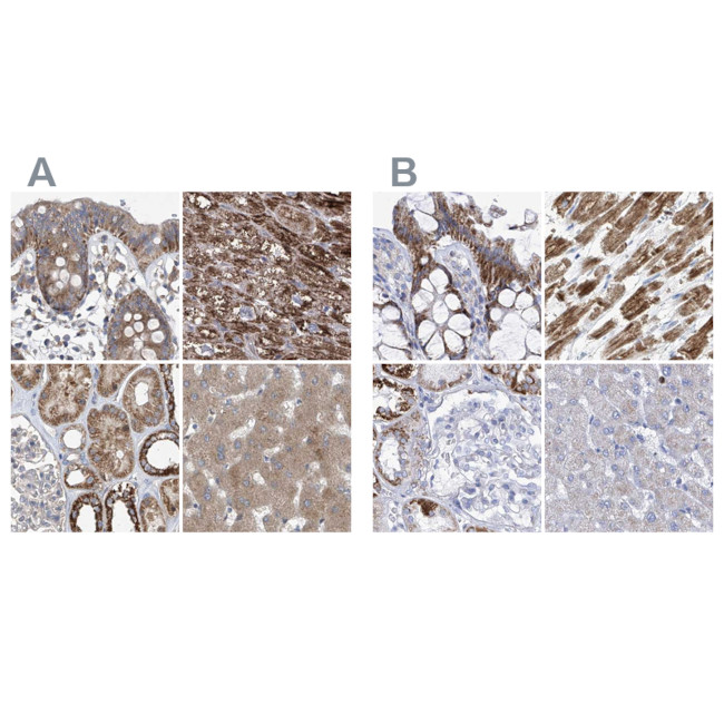 COQ3 Antibody in Immunohistochemistry (IHC)