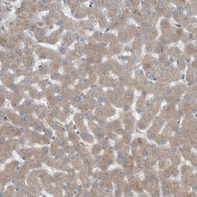 COQ3 Antibody in Immunohistochemistry (IHC)