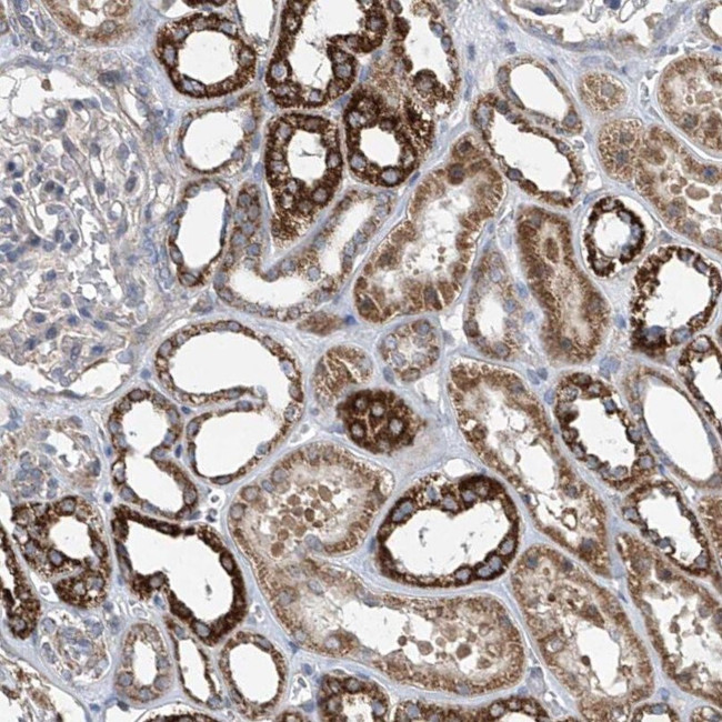 COQ3 Antibody in Immunohistochemistry (IHC)