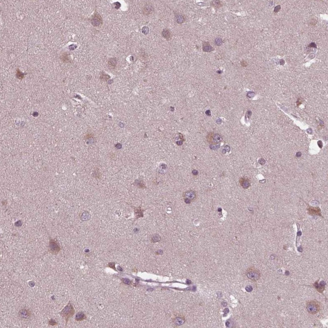 CLCN4 Antibody in Immunohistochemistry (IHC)