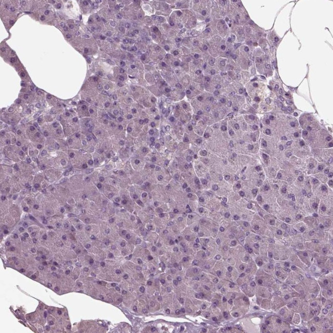 CLCN4 Antibody in Immunohistochemistry (IHC)