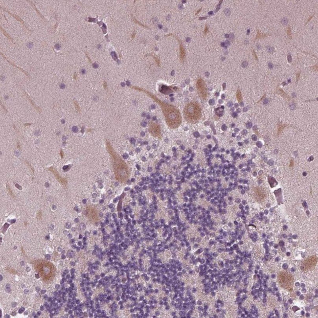 CLCN4 Antibody in Immunohistochemistry (IHC)