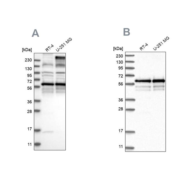 BSDC1 Antibody in Western Blot (WB)