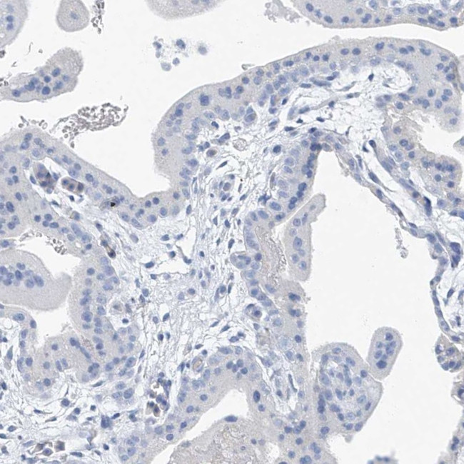 C1orf87 Antibody in Immunohistochemistry (IHC)