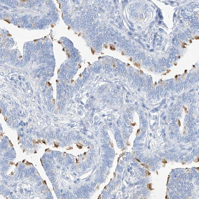 C1orf87 Antibody in Immunohistochemistry (IHC)