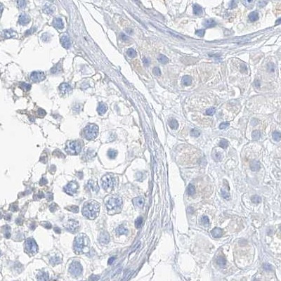 C1orf87 Antibody in Immunohistochemistry (IHC)