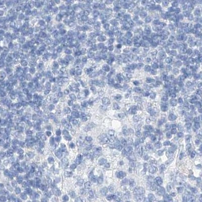 C1orf87 Antibody in Immunohistochemistry (IHC)