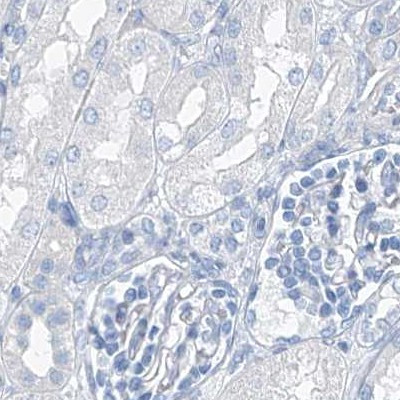 C1orf87 Antibody in Immunohistochemistry (IHC)