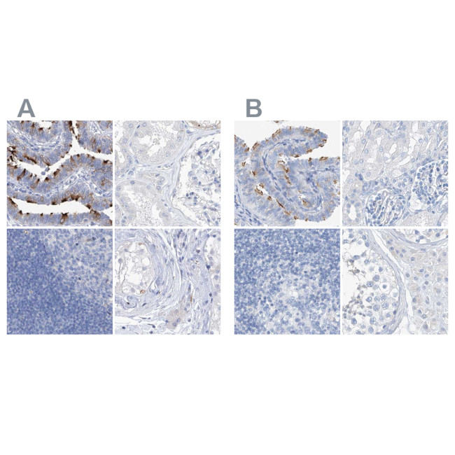 C1orf87 Antibody in Immunohistochemistry (IHC)