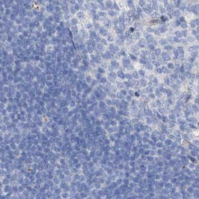 C1orf87 Antibody in Immunohistochemistry (IHC)