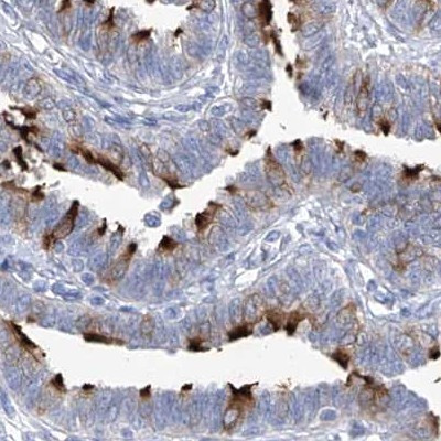 C1orf87 Antibody in Immunohistochemistry (IHC)