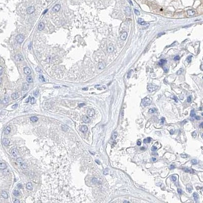 C1orf87 Antibody in Immunohistochemistry (IHC)