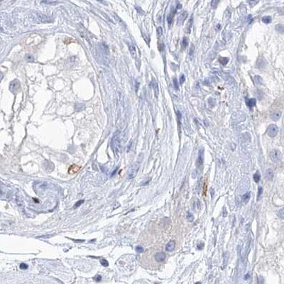 C1orf87 Antibody in Immunohistochemistry (IHC)