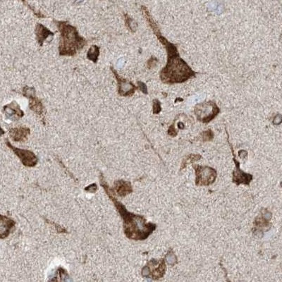 XTP3B Antibody in Immunohistochemistry (IHC)