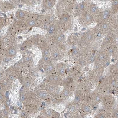 XTP3B Antibody in Immunohistochemistry (IHC)