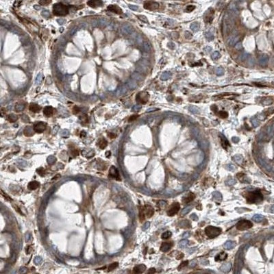 XTP3B Antibody in Immunohistochemistry (IHC)