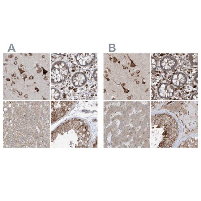 XTP3B Antibody in Immunohistochemistry (IHC)