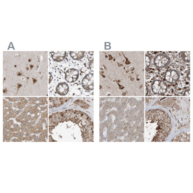 XTP3B Antibody in Immunohistochemistry (IHC)