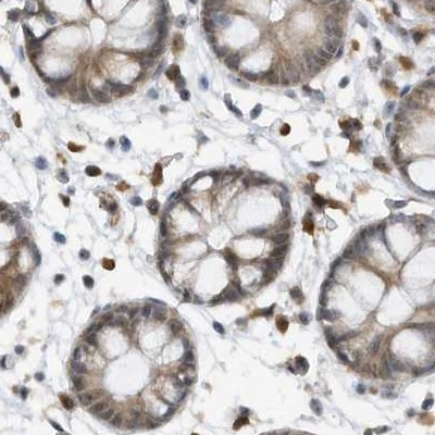 XTP3B Antibody in Immunohistochemistry (IHC)