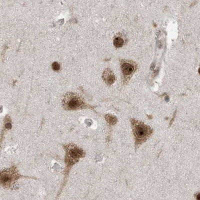 XTP3B Antibody in Immunohistochemistry (IHC)