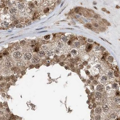 XTP3B Antibody in Immunohistochemistry (IHC)