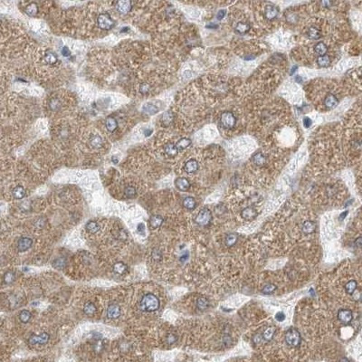 XTP3B Antibody in Immunohistochemistry (IHC)