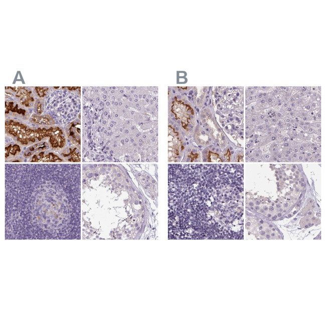 V-ATPase D Antibody in Immunohistochemistry (IHC)