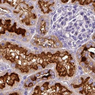 V-ATPase D Antibody in Immunohistochemistry (IHC)