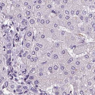 V-ATPase D Antibody in Immunohistochemistry (IHC)