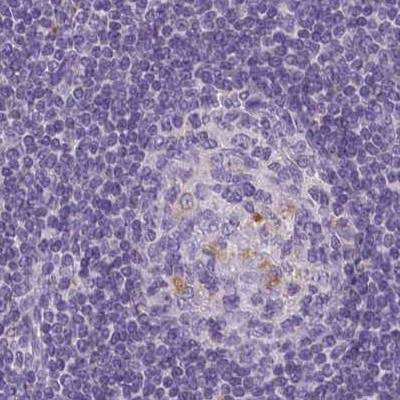 V-ATPase D Antibody in Immunohistochemistry (IHC)