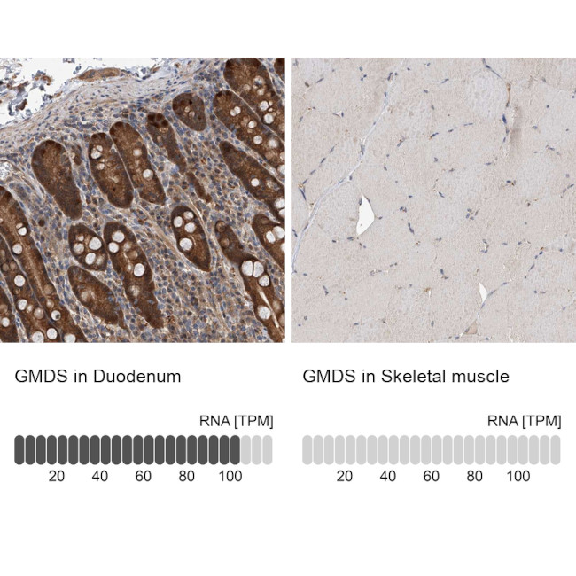 GMDS Antibody in Immunohistochemistry (IHC)