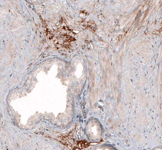 HAS3 Antibody in Immunohistochemistry (IHC)