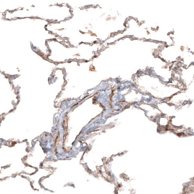 HAS3 Antibody in Immunohistochemistry (IHC)