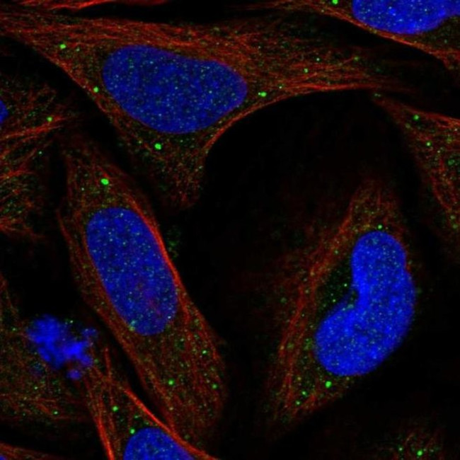 KCTD8 Antibody in Immunocytochemistry (ICC/IF)